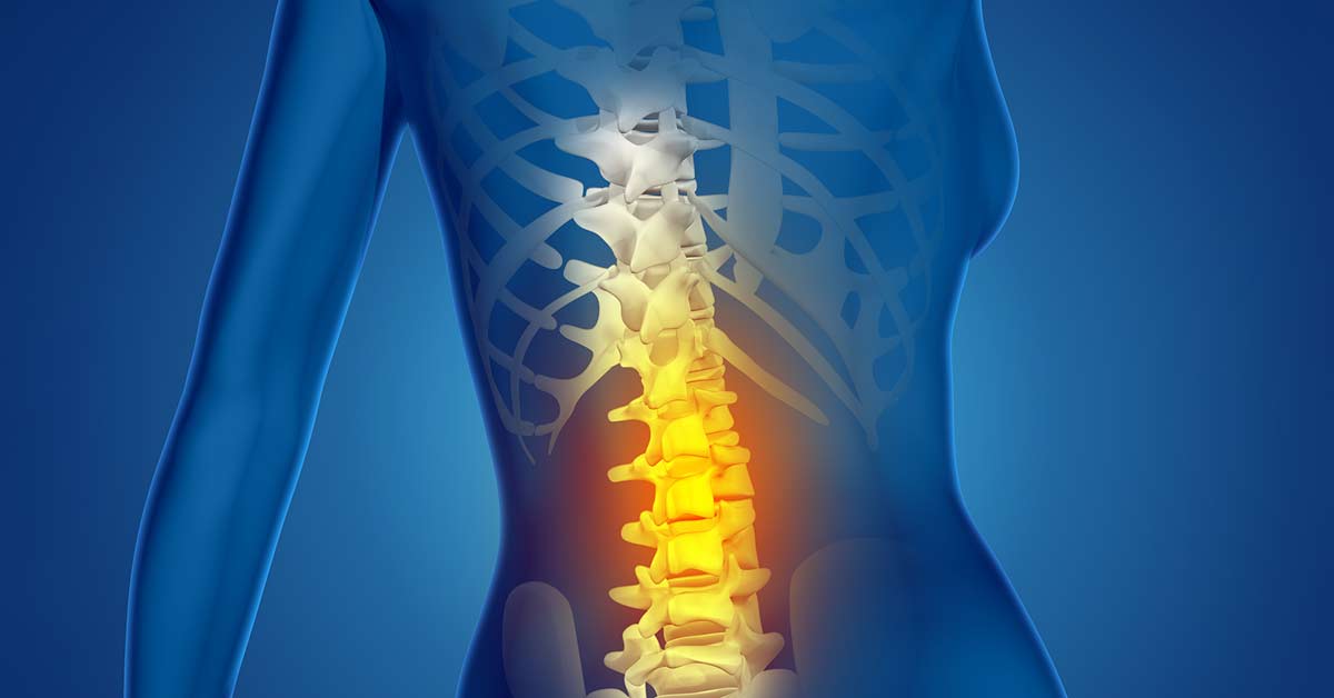 Coluna Colombo A Falha Na Coluna Vertebral Das Nossas Estrelas Estalos Na Coluna:
